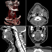 Leichhardt Medical Imaging Pic 2 - CT Scans