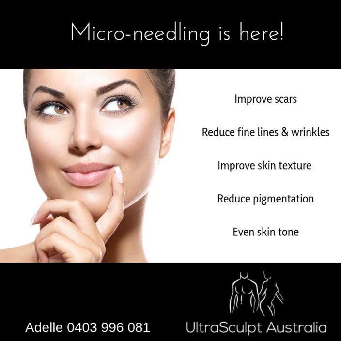 UltraSculpt Australia Pic 1 - Single Treatment 170 4 x pre paid Treatments 140 Microneedling with Radio Frequency 195 4 x pre paid Treatments 165