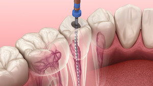 Unique Dental Pic 4