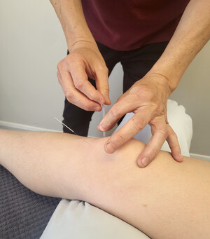 Wilston Physiotherapy & Massage Pic 3 - Acupuncture