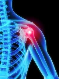 Paradise Point Physiotherapy Pic 2 - Shoulder Pain or Post Operative Rehab