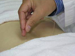 CTT Clinic Pic 1 - Acupuncture