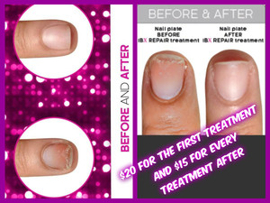 Timms Nails Pic 4 - IBX NAIL TREATMENTS