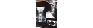 Hunter Spine And Joint Replacement Centre Pic 4