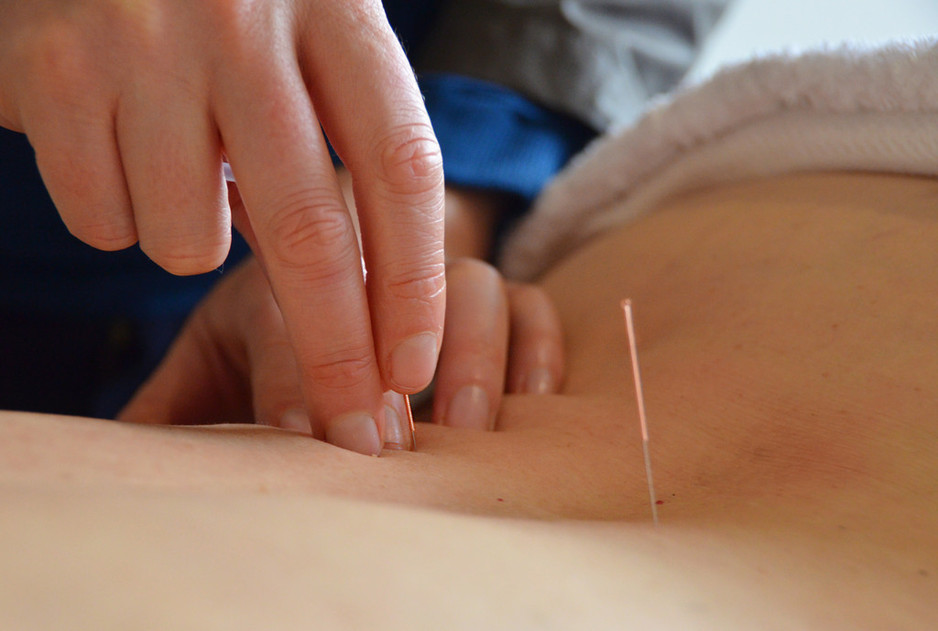 Discover Chinese Acupuncture Pic 2 - Acupuncture