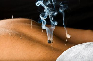 Helga Del Mundo Acupuncture Pic 4