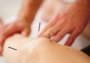 Helga Del Mundo Acupuncture Pic 5