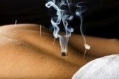 Art of Chinese Medicine Pic 4 - Moxibustion