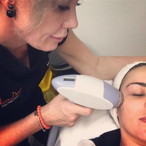 SkinDeep Dermal Clinic Pic 2 - Radio Frequency RF Skin Tightening and Plumping