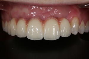 Impact Dental Ceramics Pic 5