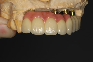 Impact Dental Ceramics Pic 2