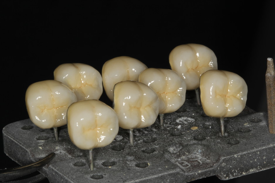 Impact Dental Ceramics Pic 1 - Army of PFM cloned crowns requested for a course