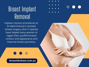 Dr Mark Kohout - Breast Lift Surgeon Sydney Pic 4 - Breast Implant Removal Sydney