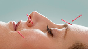 Mont Albert Acupuncture & Chinese Medicine Clinic Pic 3 - facial rejuvenation