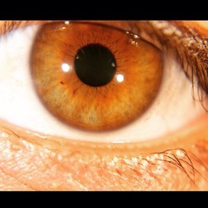 Carisma Dewi Health Care Pic 3 - Iridology Iris Analysis