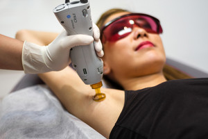 Victorian Cosmetic Dermal Clinics Camberwell Pic 3 - Laser Hair Removal