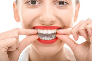 Bayswater Dentist Pic 2 - Bayswater dentist provide ivasalign with new and advanced technology