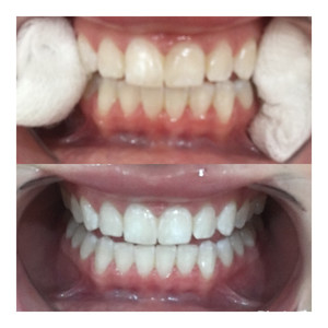 Face Clinik Pic 5 - Teeth whitening