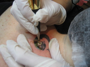 Cosmetic Ink - Sydney Tattoo Removal Pic 2 - removing tattoo