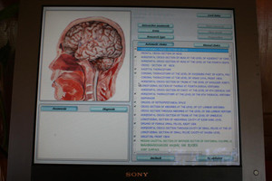 Infinitehope Pic 4 - Physiospect testing