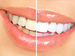 Rouse Hill Dental Pic 3