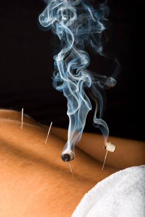 Melissa Thompson Acupuncturist Pic 2