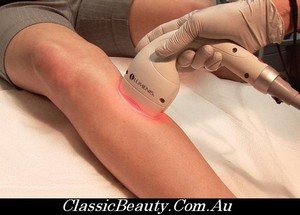 Classic Beauty Salon Pic 4 - hair Removal Sydney