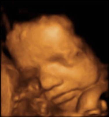 REDCLIFFE ULTRASOUND Pic 1