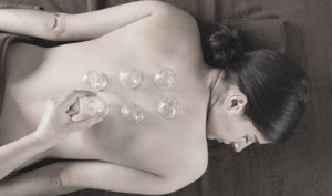 Active Remedial Massage Pic 3 - Cupping Therapy Brighton VIC