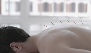 Active Remedial Massage Pic 4 - Dry Needling Brighton VIC