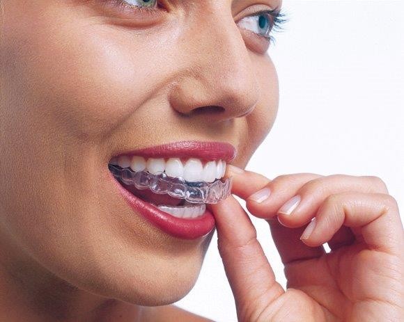 Clear Smiles Orthodontics Pic 1 - Invisalign is series of clear aligners that are practically invisible and just as effective as braces in straightening teeth Dr Semaan is the Golds Coast number one provider