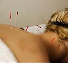 Avery Acupuncture Pic 1