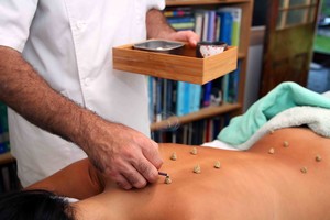 Ilan's Acupuncture Pic 2