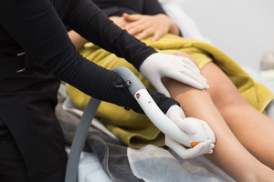 Epilase Laser & Skin Clinic Pic 5 - LightSheer Duet Laser Hair Removal Fast Effective Safe on all skin types