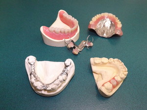 Paul Franco Denture Clinic Pic 3 - New full and partial dentures Acrylic Cobalt Chrome and Valplast flexible dentures