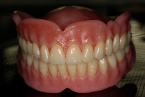 Chris Head Dental Laboratory Pic 4 - Precision crafted dentures