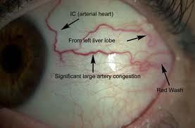 True Vitality Pic 2 - Sclerology image