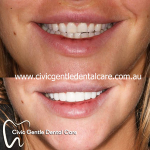 Civic Gentle Dental Care Pic 2