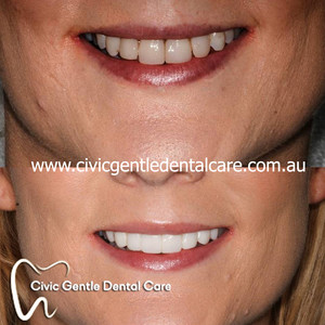 Civic Gentle Dental Care Pic 3