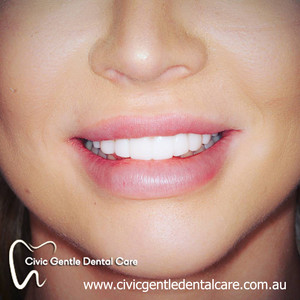 Civic Gentle Dental Care Pic 4