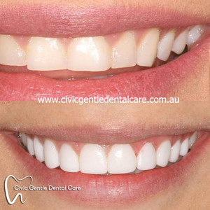 Civic Gentle Dental Care Pic 5