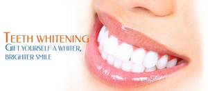 Express Teeth Whitening Canning Vale Pic 3