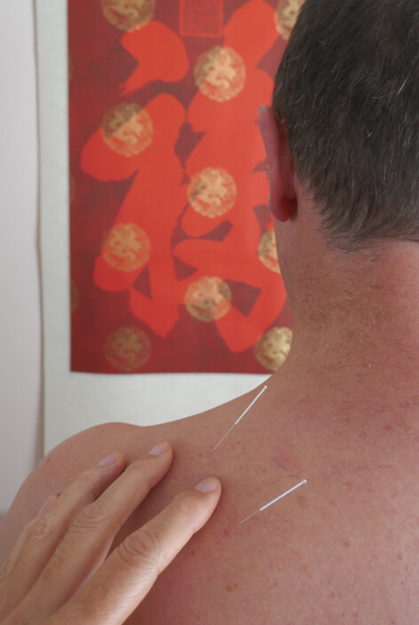 acubalance Bettina Rosche Pic 2 - acupuncture for the relief of pain