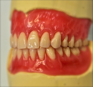 Pro Dent Clinic Pic 4 - full denture as a wax try in