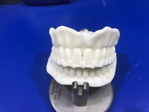 Kroma Ceramics Pic 4 - 3D printed tryin Dentures