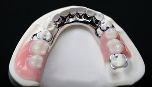 Denture Mt Gravatt Pic 5