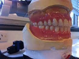 Denture Mt Gravatt Pic 2