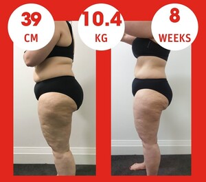 Body Shaping Zone Sydney CBD Pic 2 - Weigh loss results