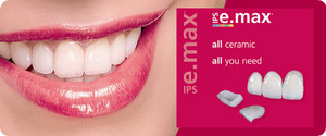 Park Terrace Dental Pic 5 - High quality Emax Ceramic used