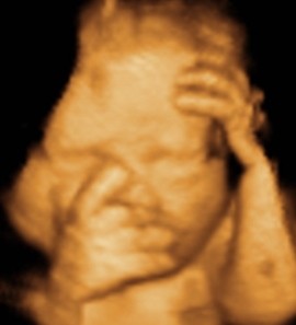 Ultrasound & X-Ray Acacia Ridge Pic 1